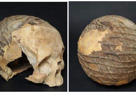 Открыт секрет 9000-летнего черепа, покрытого асфальтом (фото)