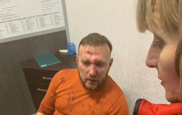Пострадавшего от нападения неонацистов политконсультанта Андрея Бодрова обследуют медики 12 декабря 2018.